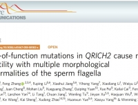 精子尾部畸形重大研究成果发表在《Nature Communications》
